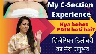 My Labor & Delivery Story in Hindi | My C-Section Experience | मेरा सिजेरियन का अनुभव केसा रहा