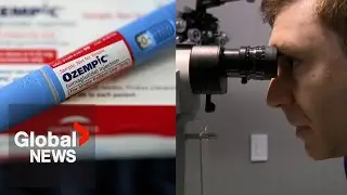 Ozempic, Wegovy use may be linked to 