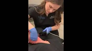 Morpheus8 Treatment to Inner Thighs and Neck | Dr. David P. Rapaport NYC