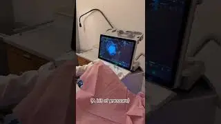 Inside a Fertility Ultrasound