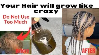 Your hair wouldn&rsquo;t stop Growing! Use Twice A Week only For Shocking Results| Overnight Hair Spray&hellip;