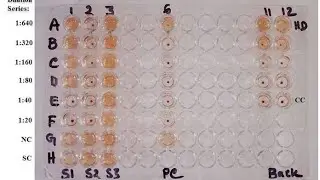 COMPLEMENT FIXATION TEST(CFT)