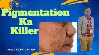 Tranexamic acid in Skincare | Doctor Advice | Hindi