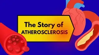 Atherosclerosis Pathophysiology Explained | From Endothelial Dysfunction to Thrombosis