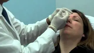 Botox Vancouver  | Botox Burnaby  | Wrinkles  | Frown lines/wrinkles