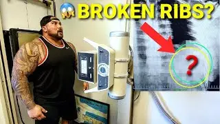 (SHOCKING) X-RAY RESULTS FROM MY 
