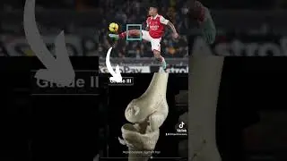 Gabriel Jesus Knee Injury Explained | #arsenal #arsenalfc #afc #epl #premierleague #footballnews