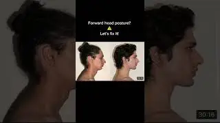 Forward head posture? Let&rsquo;s fix it