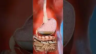 What Happens If You Swallow Mentos And Coke 😨