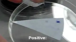 Microbiology oxidase test