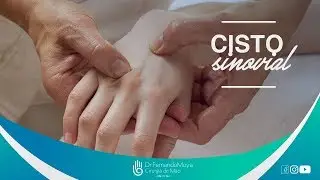 Cisto sinovial | Por Dr. Fernando Moya CRM 112.046