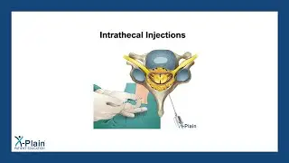 Intrathecal Injections