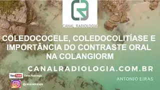 Coledococele, coledocolit&iacute;ase e a import&acirc;ncia do contraste oral