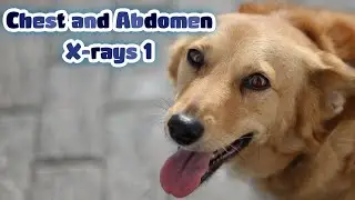 Chest and Abdomen X-rays 1