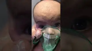 Baby Recovery Frome Broncholitis | treatment and recovery #bronchiolitis #nebulization #neonatalcare