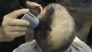 Super Million Hair - густые волосы за 10 секунд! (InterCharm 2011)