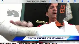 FIRST AID: BANDAGING OF AN IMPALED OBJECT