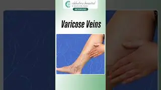Best Varicose Vein Treatment at Chhabra Hospital: Non-Surgical Laser Treatment by Experts