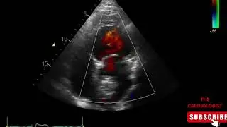 LA MYXOMA