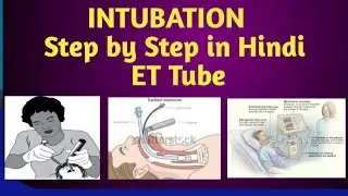 Intubation Procedure | Step by Step With Equipment | Nursing skill Hindi | #nursing