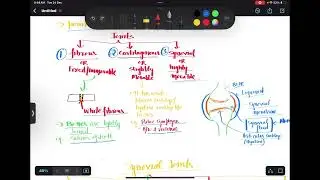 Understanding Joints: Types, Functions, and Common Disorders Explained