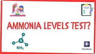 What is an ammonia levels test?
