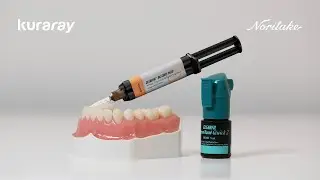 Post cementation & core build-up workflow | CLEARFIL Universal Bond Quick 2 + CLEARFIL DC CORE PLUS