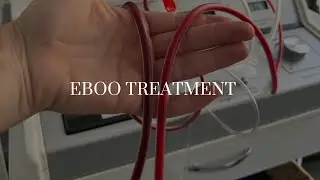 What Is EBOO Treatment? Blood Filtration Explained for Chronic Inflammation | IVElements.net