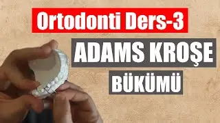 Ortodonti Adams Kroşe Bükümü