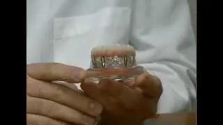 Macomb County, MI Dental Implants- The New Denture Replacement?