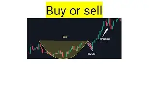 Sol Gel Technologies, slgl stock analysis buy or sell