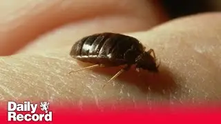 Glasgow named 'bedbug capital' of Scotland as residents battle hundreds of infestations