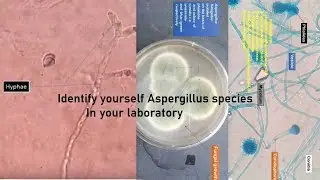 Aspergillus in KOH mount, grow on SDA, LPCB Preparation showing Condia,Conidiophores,Phialides