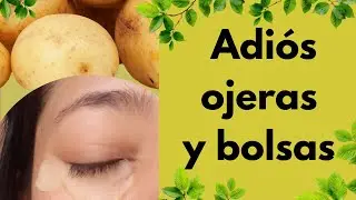 Adi&oacute;s ojeras y bolsas con este s&uacute;per ingrediente!!!