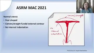 Мюллеровы аномалии &ndash; новая классификация ASRM MAC 2021, подготовленная доктором Анджали Кавталкар.