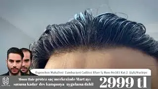 MOON HAIR Kalite ve