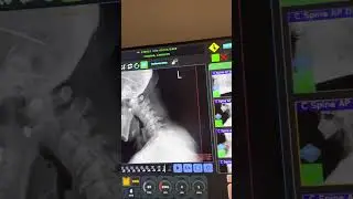 DDR X-ray. Precision analysis equals precision care which equals fast results.