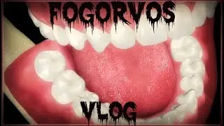 Baron Galdaros VLOG 008- FOGORVOSN&Aacute;L VOLTAM!!- Felt&aacute;r&aacute;sos b&ouml;lcsess&eacute;gfog elt&aacute;vol&iacute;t&aacute;s (VITALIT&Aacute;S)