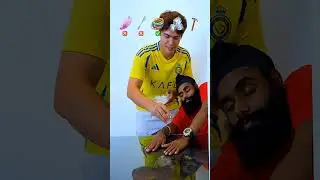 CON JOINED TWINS THEIR FEELINGS 😍, #viral
