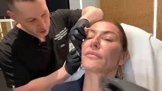 Sculptra | Collagen-Stimulating Injections | West Hollywood, CA | Dr. Jason Emer