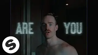 Will Sparks - Are You Crazy (Official Music Video)