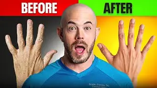 Heal Cracked Fingers FAST: Dermatologist&rsquo;s Proven Method!