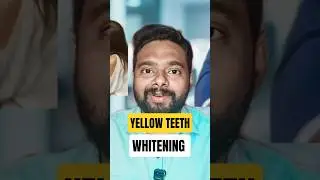 teeth whitening procedure smile correction #arogyam #dentalcare #dentalclinic