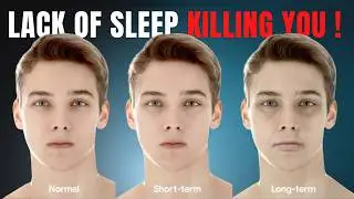 Is Sleep Deprivation Killing You? (Simple Science-Backed Tips to Fall Asleep Fast)