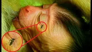 Look-Look Worry ! Biig Mosquito bite eye Newborn baby monkey | Mom not know baby hurt.
