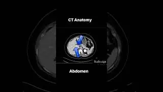 #anatomy #ct #mritech  #cttechnologist #USMLE #radio #medicine #students