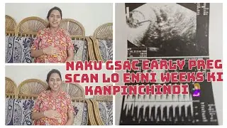 Early Pregnancy🤰🏼 Scan lo G-Sac kanpadakapothe Miscarriage avtunda? #longvideo #watchtillend #vlog