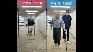 脊髄梗塞/発症2年/60代男性｜対麻痺からの“歩行レベルアップ”に挑んだ改善事例②  #脊髄梗塞 #対麻痺 #リハビリ #歩行リハビリ #自費リハビリ #脳神経リハビリセンター