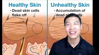 Stop Damaging Your Skin! The Right Way to Exfoliate & Control Sebum / Atomy Bro