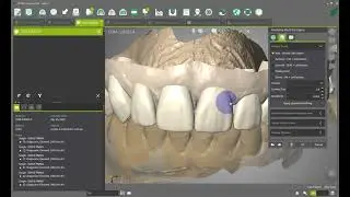 DWOS - Create a diagnostic wax up